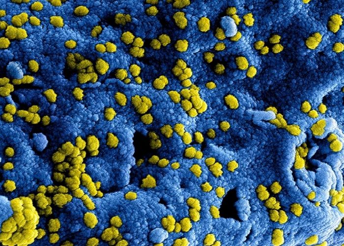 4 Wabah Virus Ini Pernah Melanda Dunia, Terbaru Corona