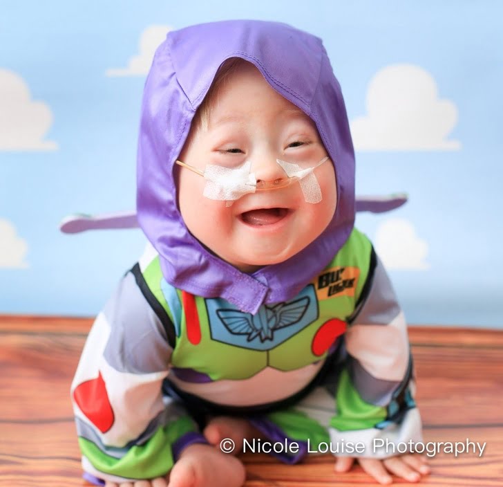 Bikin Haru, 10 Potret Anak Down Syndrome Pakai Kostum Disney Favorit