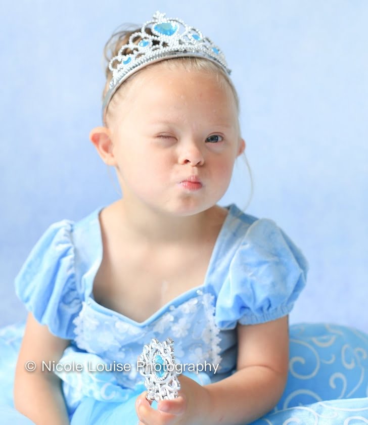 Bikin Haru, 10 Potret Anak Down Syndrome Pakai Kostum Disney Favorit