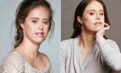 10 Potret Chelsea Werner, Penderita Down Syndrom yang Wujudkan Mimpinya Jadi Model dan Atlit