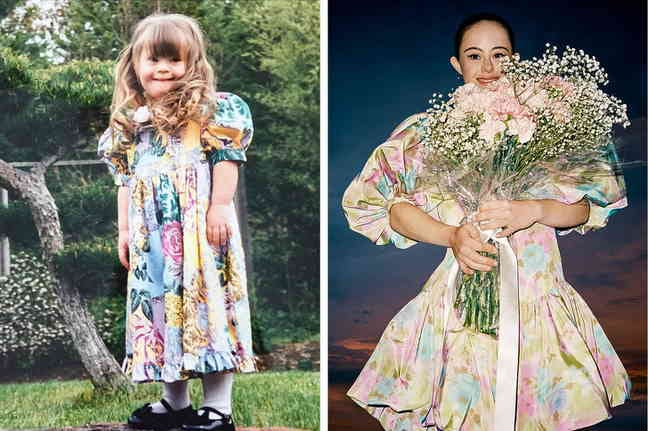 10 Potret Chelsea Werner, Penderita Down Syndrome yang Mewujudkan Impiannya Menjadi Model dan Atlet