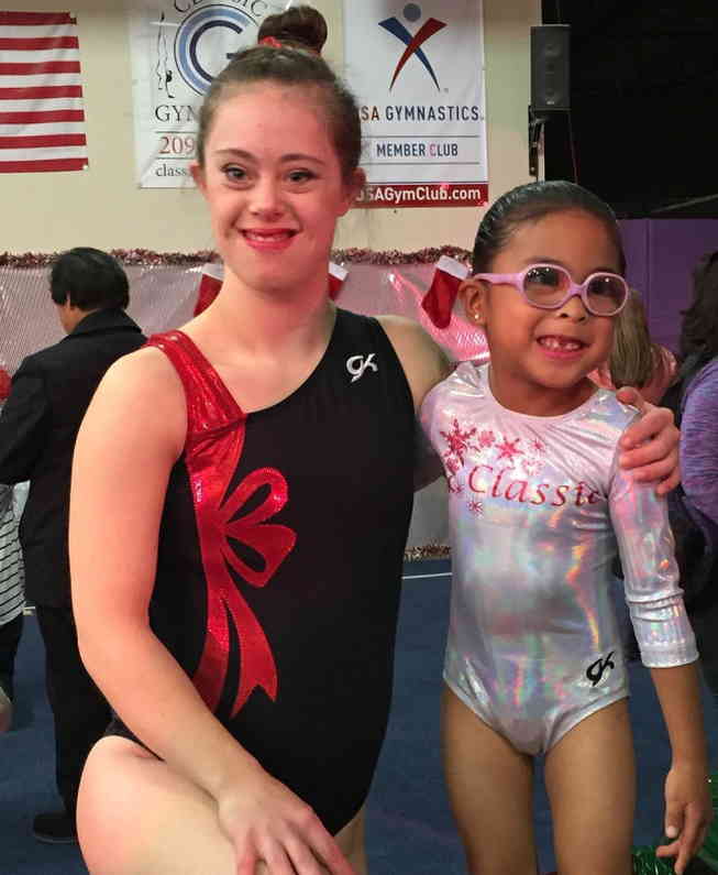10 Potret Chelsea Werner, Penderita Down Syndrome yang Mewujudkan Impiannya Menjadi Model dan Atlet