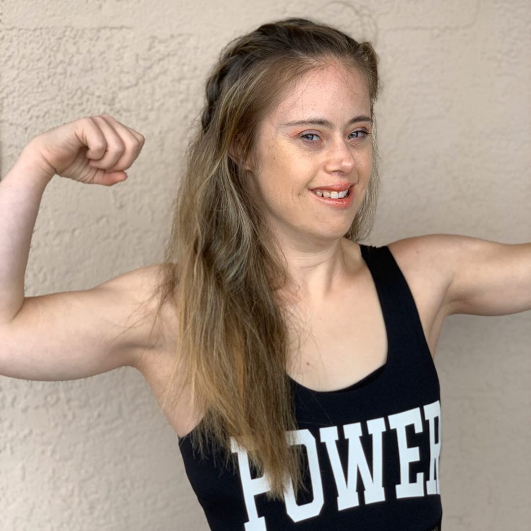 10 Potret Chelsea Werner, Penderita Down Syndrom yang Wujudkan Mimpinya Jadi Model dan Atlit