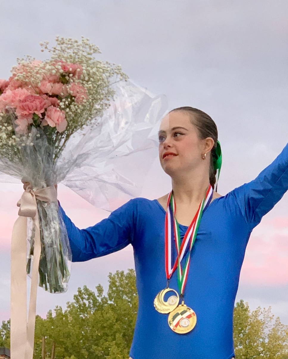 10 Potret Chelsea Werner, Penderita Down Syndrome yang Mewujudkan Impiannya Menjadi Model dan Atlet