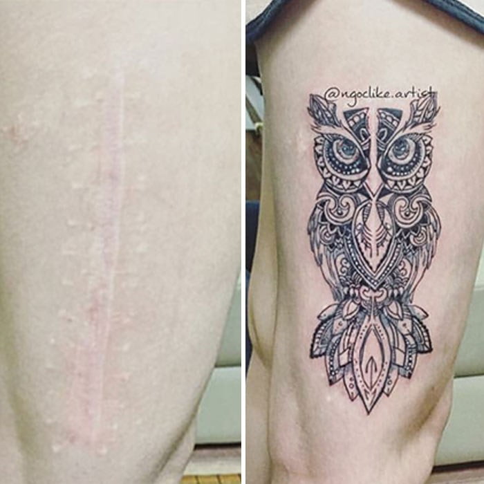 10 Desain Tato Potret yang Dibuat untuk Menutupi Bekas Luka di Kulit