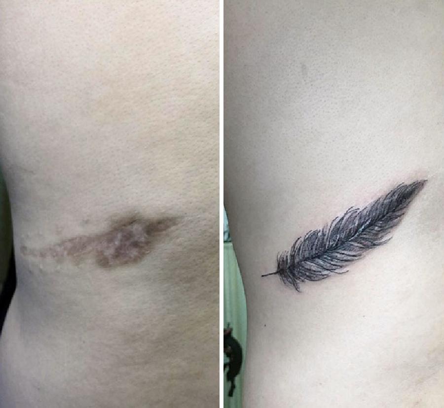 10 Desain Tato Potret yang Dibuat untuk Menutupi Bekas Luka di Kulit