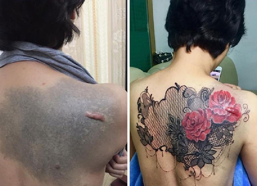 10 Desain Tato Potret yang Dibuat untuk Menutupi Bekas Luka di Kulit