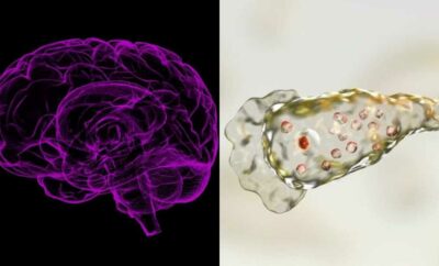Naegleria fowleri, Amuba Pemakan Otak yang Sebebkan Infeksi Langka pada Manusia