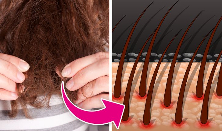 10 Kebiasaan yang Harus Ditinggalkan Agar Rambutmu Tak Tampak Tipis