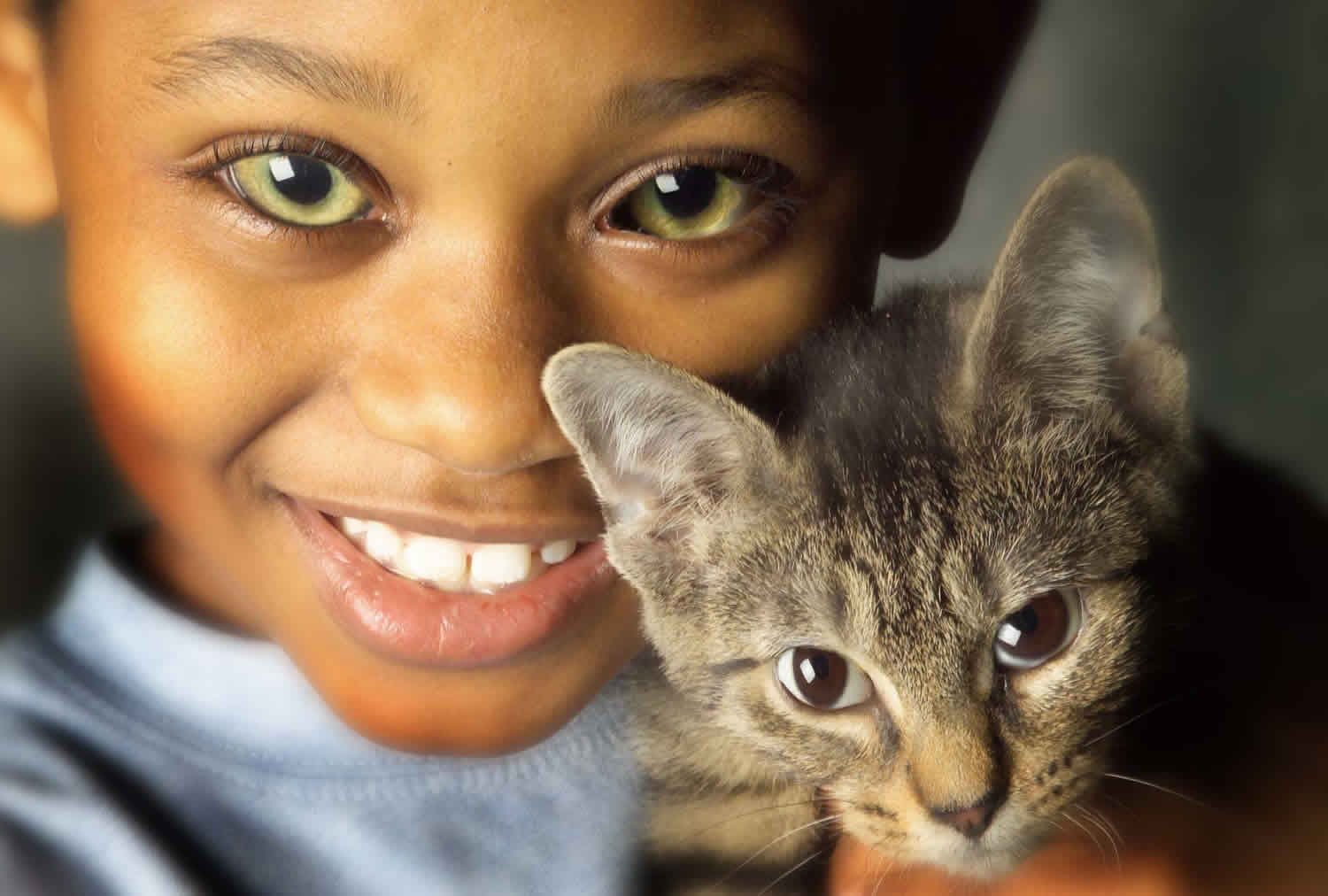 Cat Eye Syndrome, Kondisi Langka Pemilik ‘Mata Kucing’