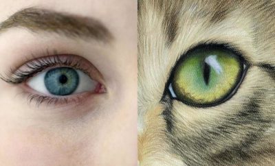 Cat Eye Syndrome, Kondisi Langka Pemilik ‘Mata Kucing’