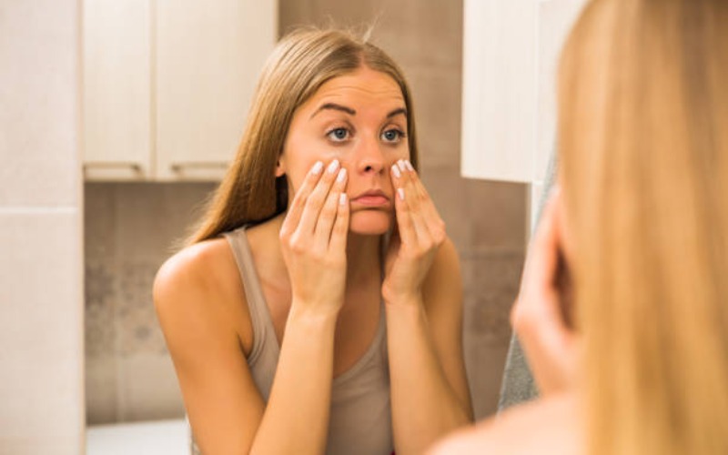 10 Effective Ways to Get Rid of Panda Eyes, You can Try at Home