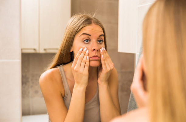 9 Cara Menghilangkan Eye Bags, Dijamin Ampuh